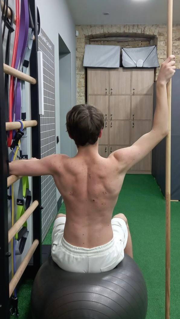 Физическая терапия сколиоза